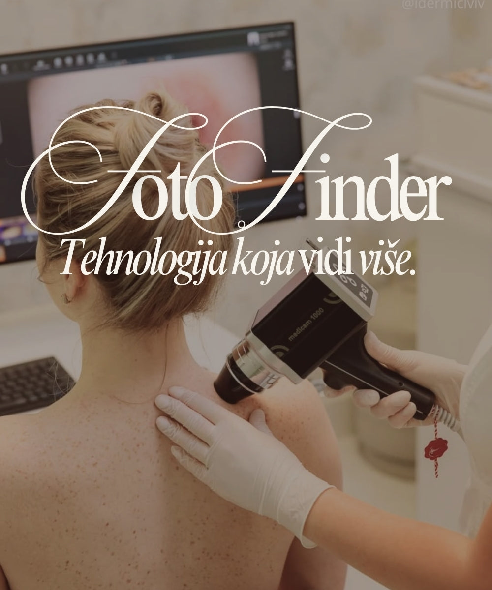 Digitalno mapiranje kože koje vidi više: FotoFinder
