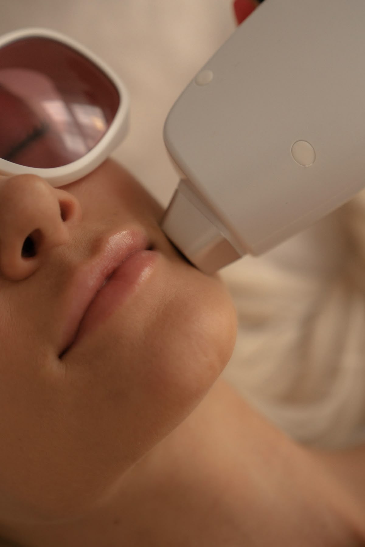 LASERSKI TRETMAN AKNI