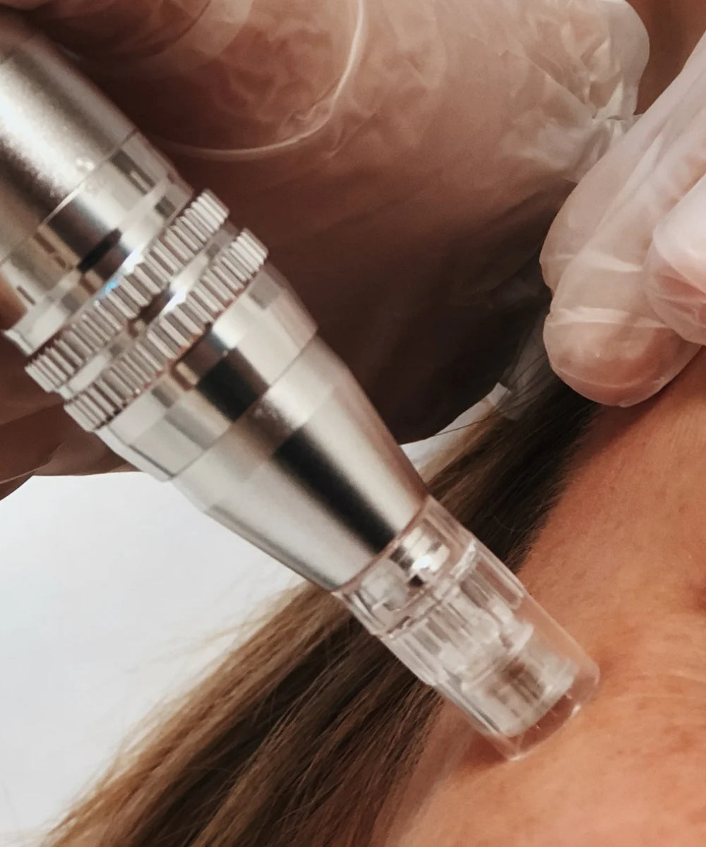 Close-up of a microneedling mesoestetic m pen held by a person wearing gloves.