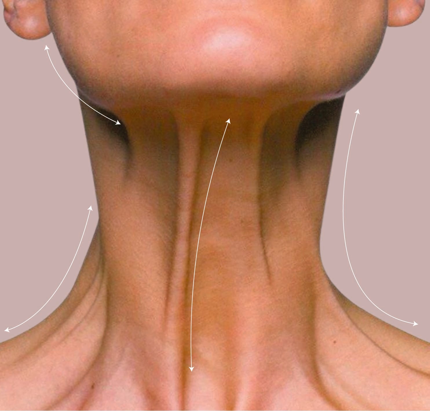 Close-up of a person's neck with arrows pointing to different areas.